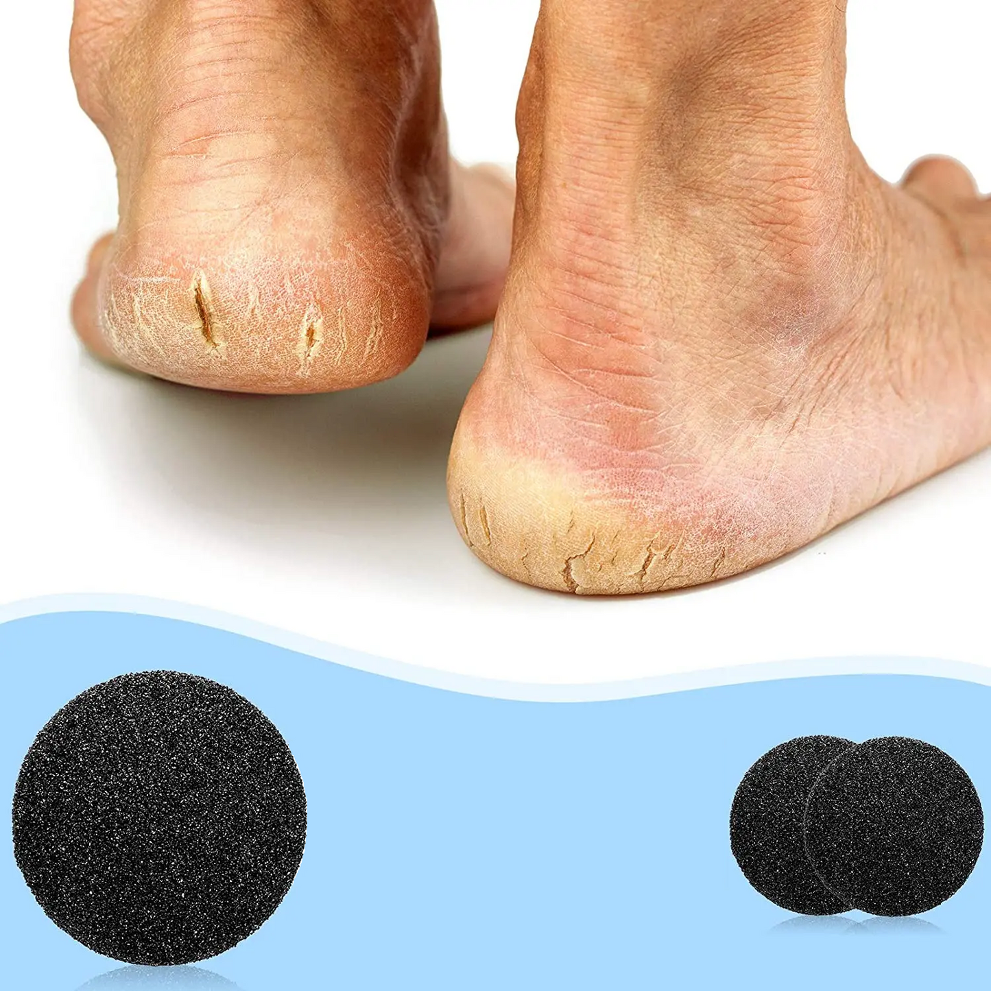 Callus and Crack Remover 