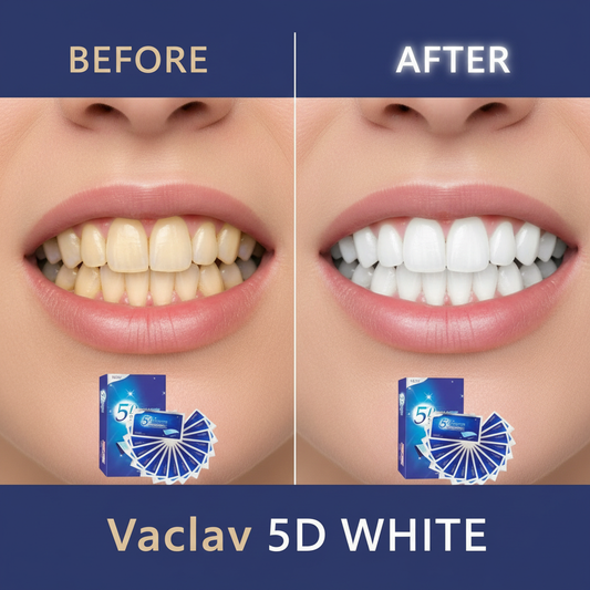 Tiras Clareadoras 5D – 7/14/21/28 Pares para Remover Manchas e Clarear os Dentes em Casa