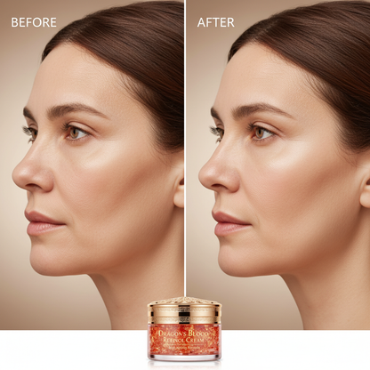 Creme Facial Retinol Dragon's Blood – Hidratação Intensa e Renovação da Pele